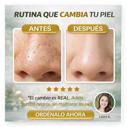 Anua™ Aceite limpiador que Elimina la grasa y suciedad de tus poros desde el primer uso